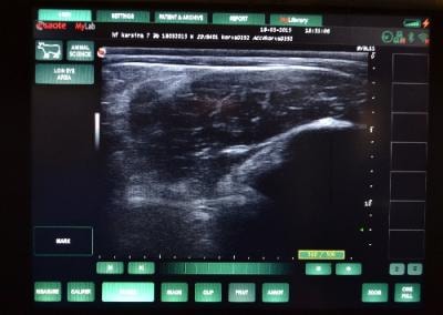 Kuva sonnin ultraäänimittauksen näyttökuvasta